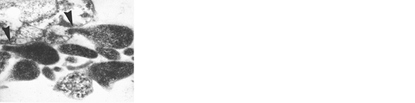 NL3 abb1