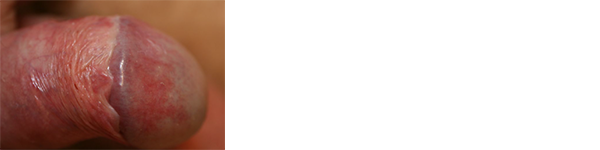 NL3 abb3